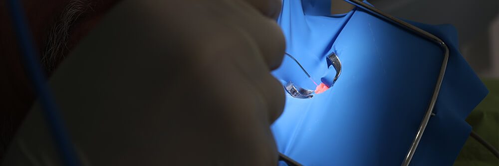 Laser terapia