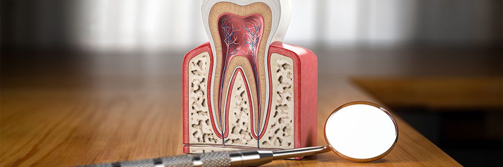 Endodonzia devitalizzazione